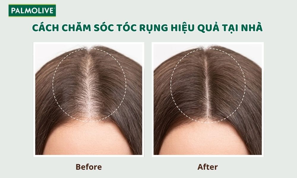 Pal_Thumbnail - how-to-care-for-hair-loss