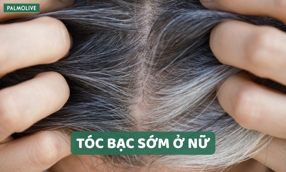 KW - tóc bạc sớm ở nữ - premature-gray-hair-in-women
