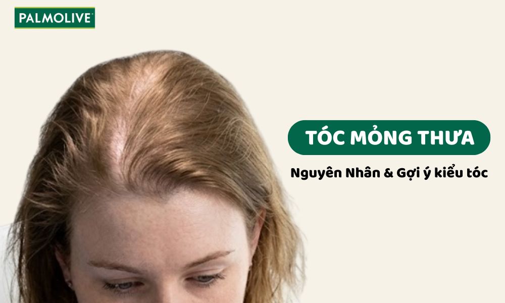 Pal_Thumbnail - thin-and-sparse-hair 