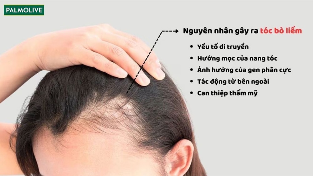 5 nguyên nhân chính gây ra tình trạng tóc bị bò liếm