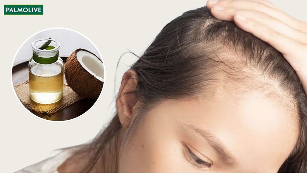 Cải thiện tóc bò liếm bằng cách ủ tóc bằng dầu dừa