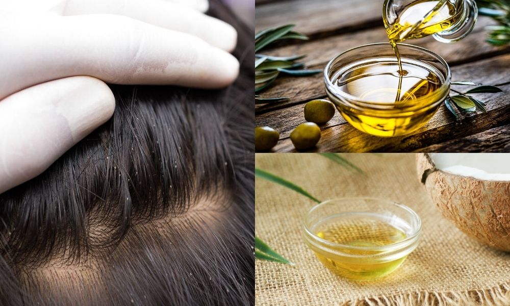 Các loại dầu thực vật giúp tạo lớp màng ngăn chấy hấp thụ oxy