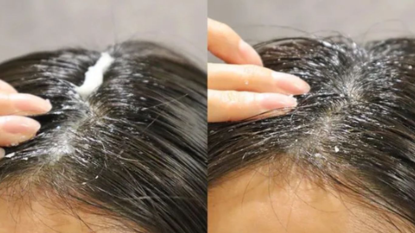 Các bước tẩy tế bào chết da đầu