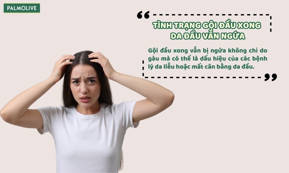 Gội đầu xong vẫn ngứa có thể xuất phát từ gàu, bệnh lý da đầu và thói quen chăm sóc tóc