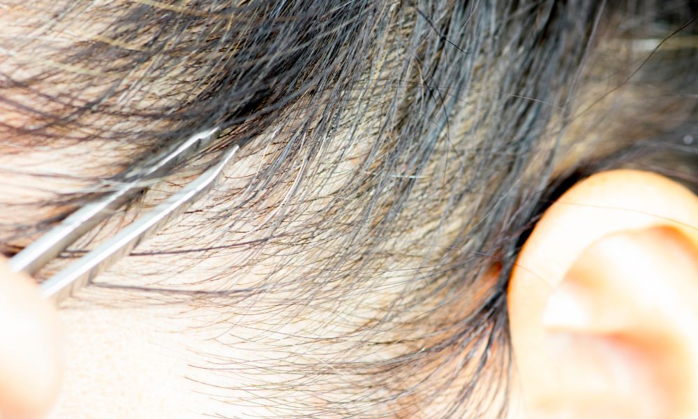 Hạn chế nhổ tóc bạc để tránh làm tổn thương nang tóc