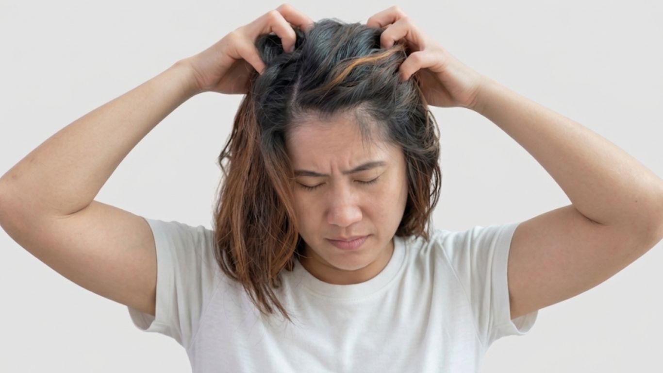 Chất Sulfate có thể gây kích ứng và gây ngứa da đầu