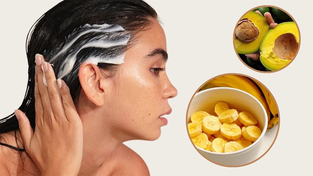 Ủ tóc bằng bơ và chuối giúp hỗ trợ trị ngứa da đầu