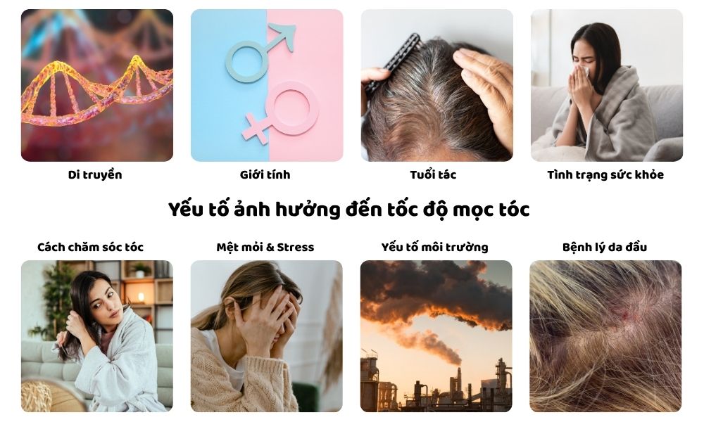 Các yếu tố ảnh hưởng đến quá trình mọc tóc Các yếu tố ảnh hưởng đến quá trình mọc tóc