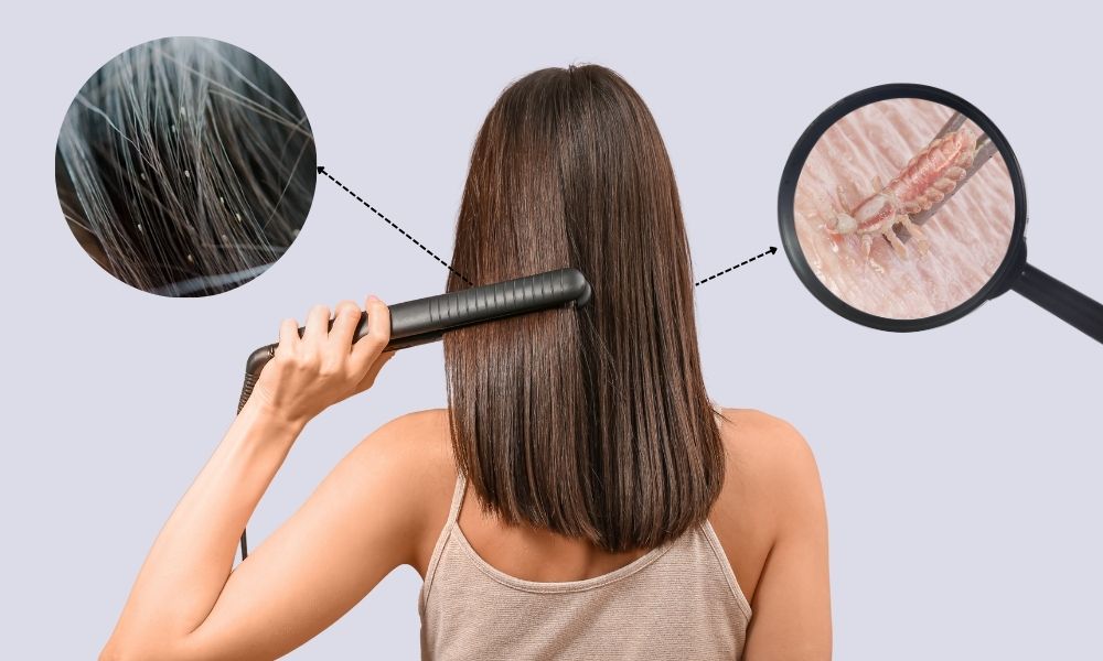 Ép tóc có hết chấy không Ép tóc có hết chấy không