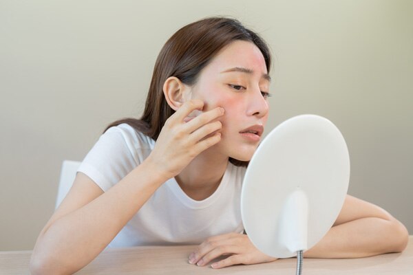 tinh dầu tràm trị mụn tinh dầu tràm trị mụn