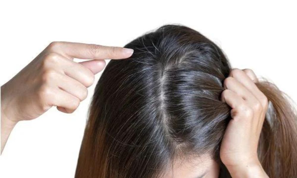 Tóc ngứa xoăn (tóc sâu) là tóc mọc xoăn, cứng, dày Tóc ngứa xoăn (tóc sâu) là tóc mọc xoăn, cứng, dày